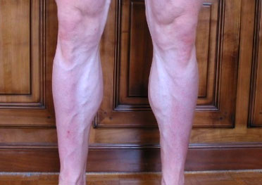 Musculation des triceps suraux/mollets (jambes)