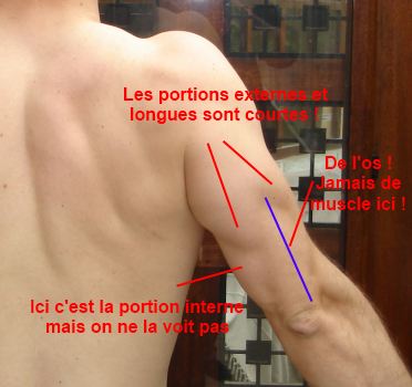 Analyse morpho-anatomique : Fabrice